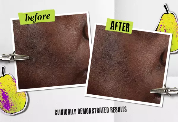 before and after on various skin tones