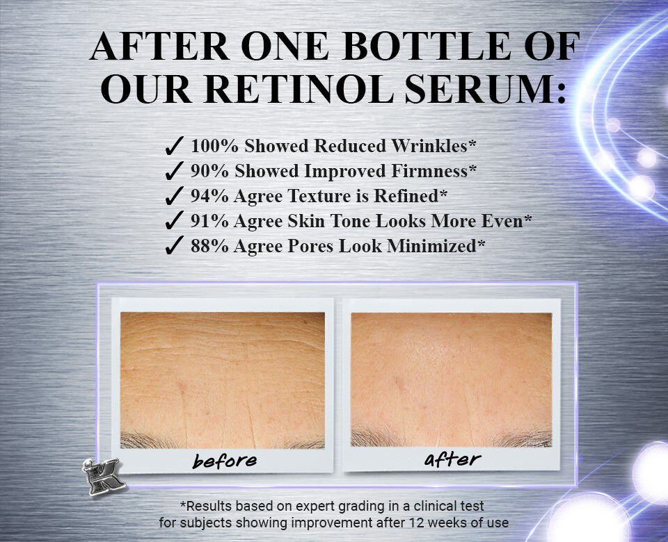 After One Bottle of our Retinol Serum