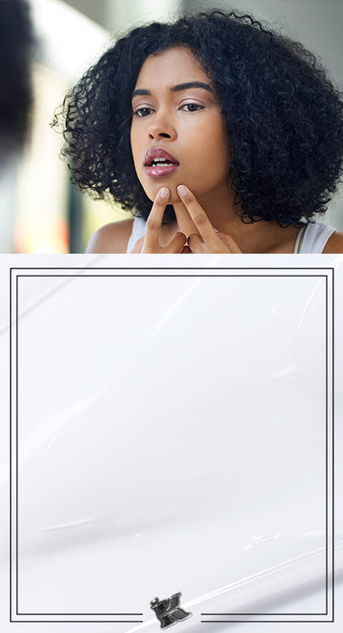 5 Common Causes of Acne Breakouts