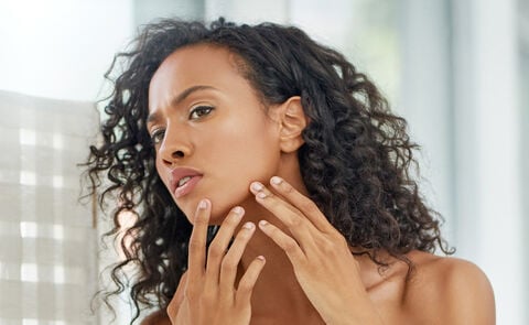 What Is Fungal Acne?