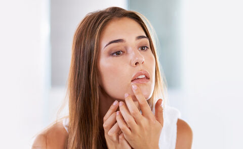 Asked and Answered: Is It Okay To Pick At and Pop Pimples?