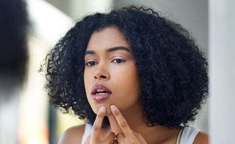 Why Do I Have Acne? 5 Potential Causes Of Your Breakouts